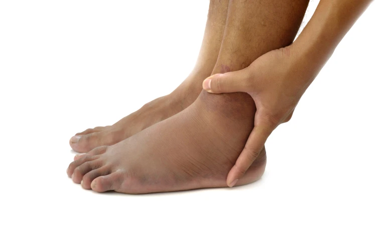 أعراض جلطة القدم